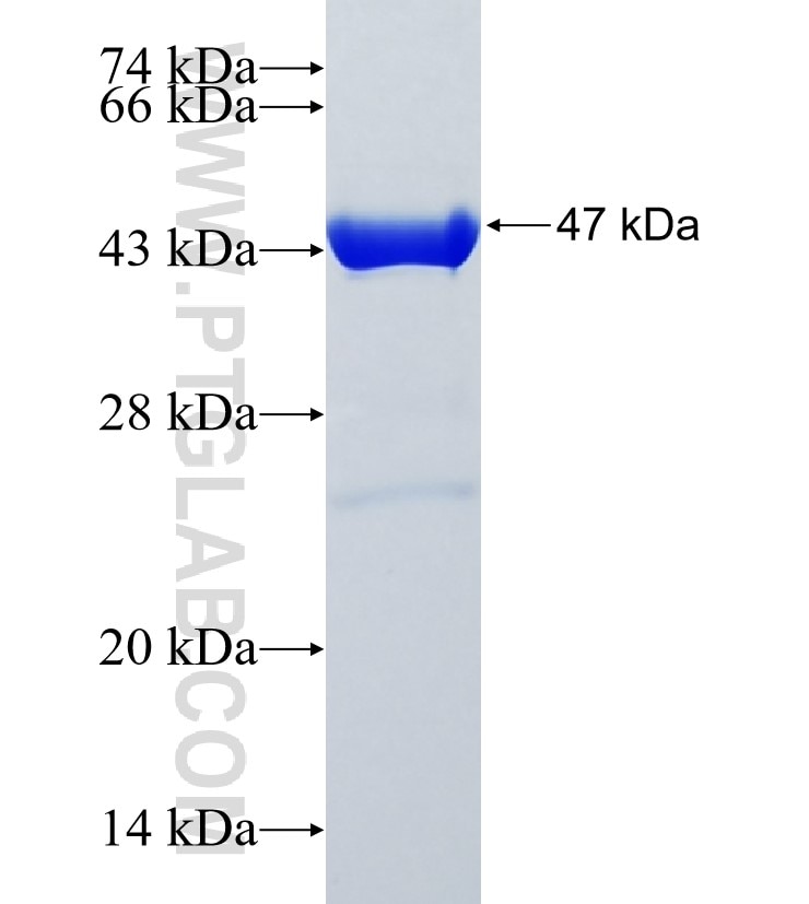 ANP32CP fusion protein Ag35293 SDS-PAGE
