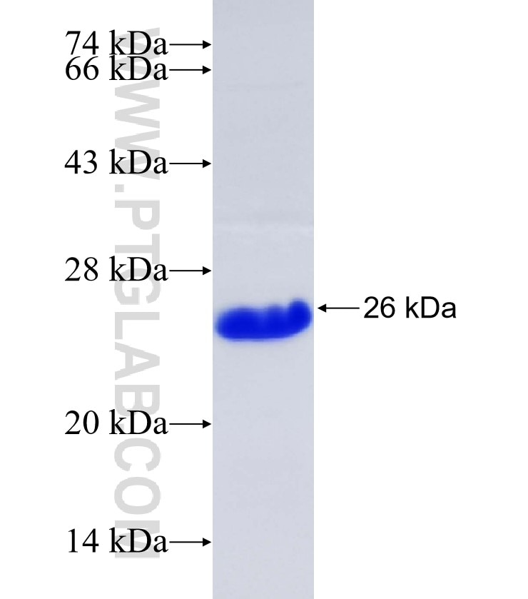 ANP32CP fusion protein Ag35339 SDS-PAGE