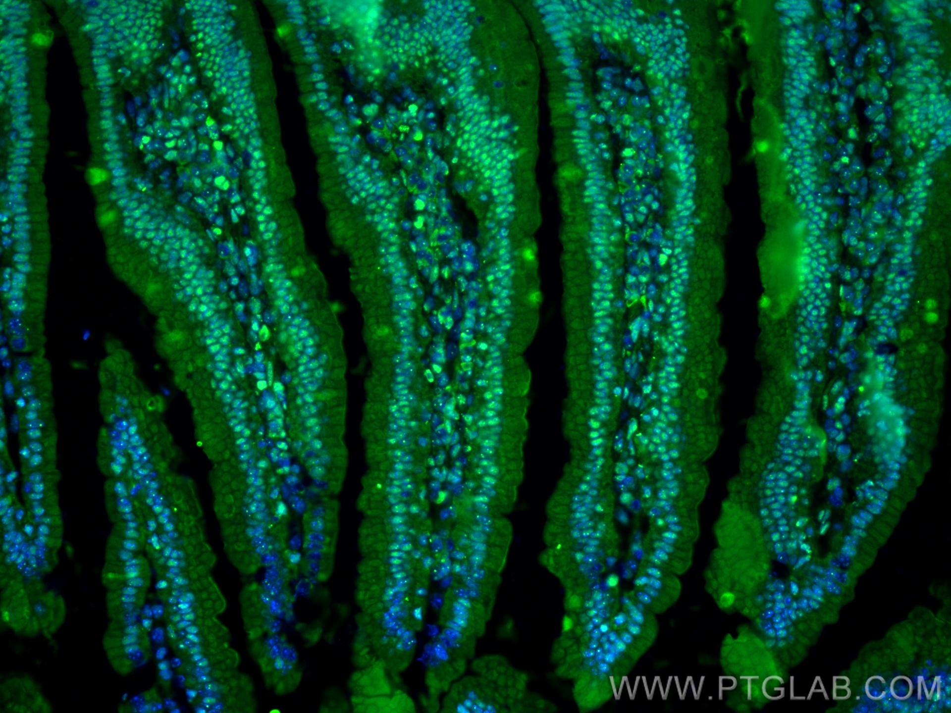 Immunofluorescence (IF) / fluorescent staining of mouse small intestine tissue using ANP32E Polyclonal antibody (31989-1-AP)