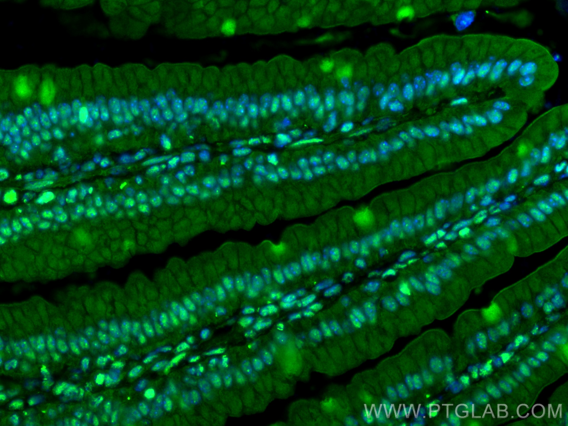 Immunofluorescence (IF) / fluorescent staining of mouse small intestine tissue using ANP32E Polyclonal antibody (31989-1-AP)