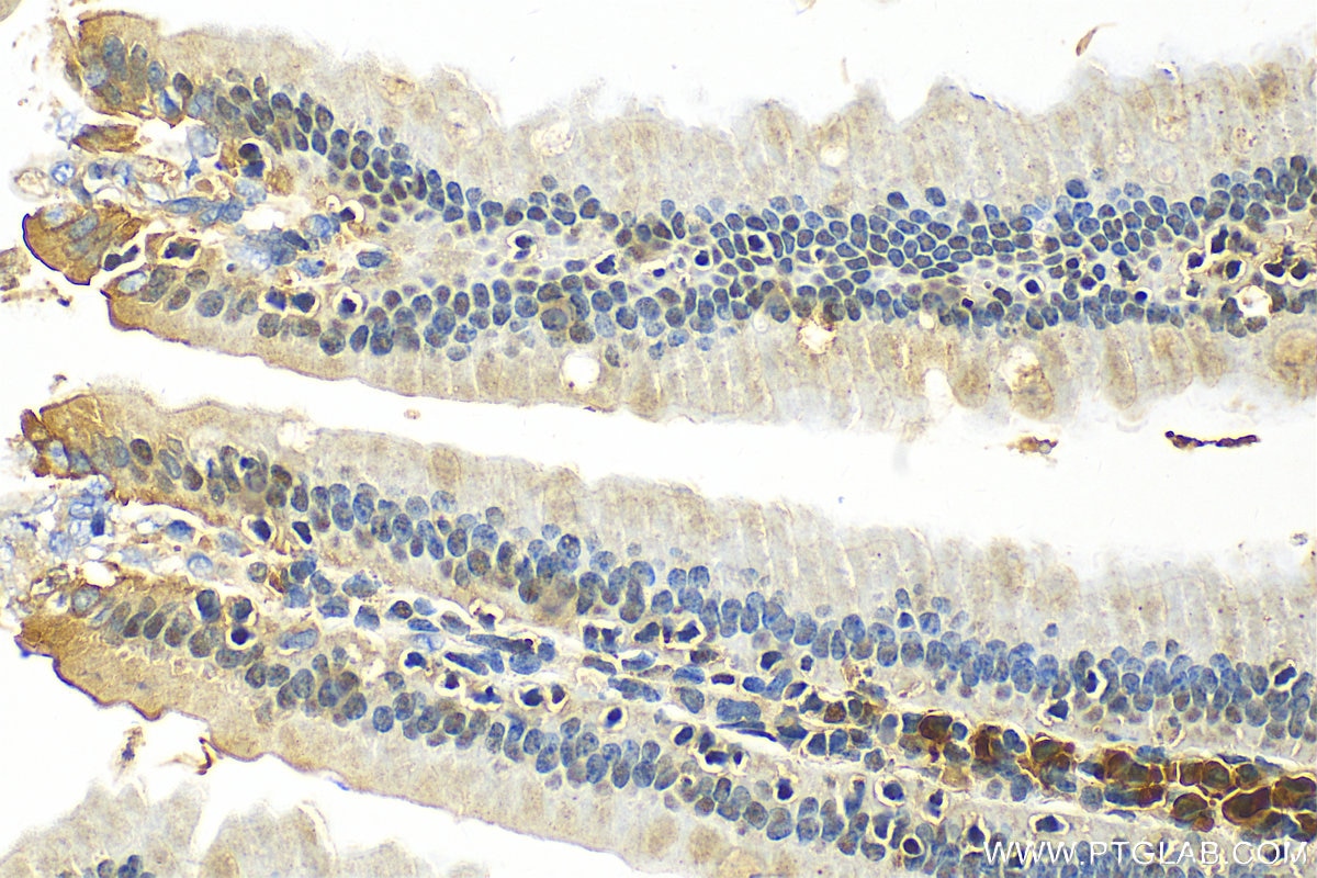 Immunohistochemistry (IHC) staining of mouse small intestine tissue using ANP32E Polyclonal antibody (31989-1-AP)