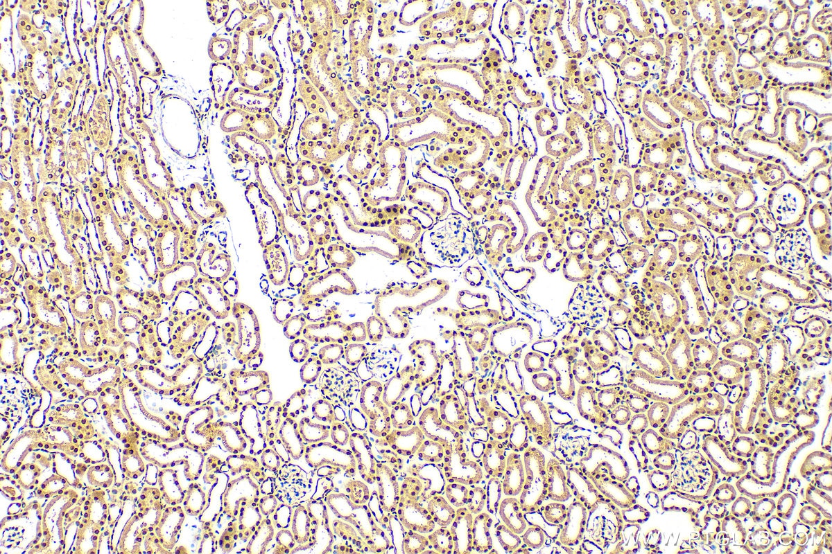 Immunohistochemistry (IHC) staining of mouse kidney tissue using ANP32E Polyclonal antibody (31989-1-AP)