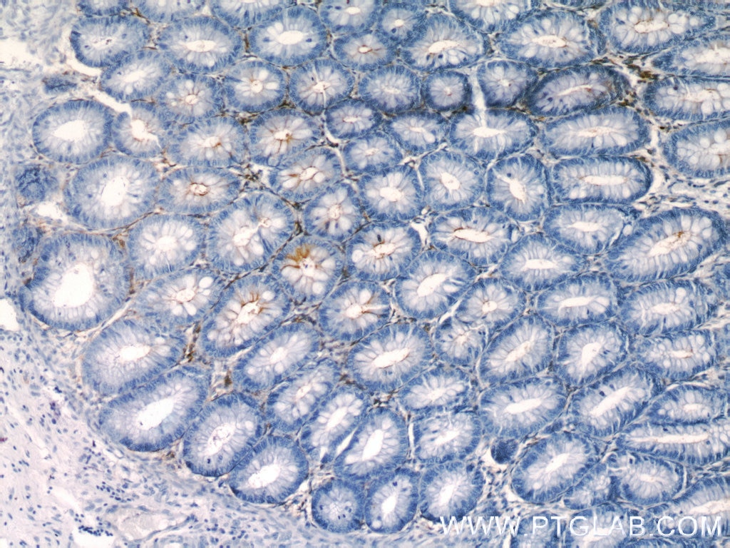 Immunohistochemistry (IHC) staining of human colon tissue using CD13 Polyclonal antibody (14553-1-AP)