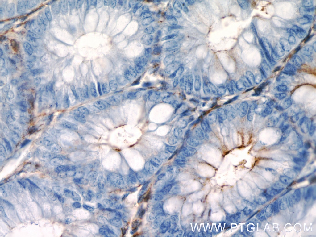 Immunohistochemistry (IHC) staining of human colon tissue using CD13 Polyclonal antibody (14553-1-AP)