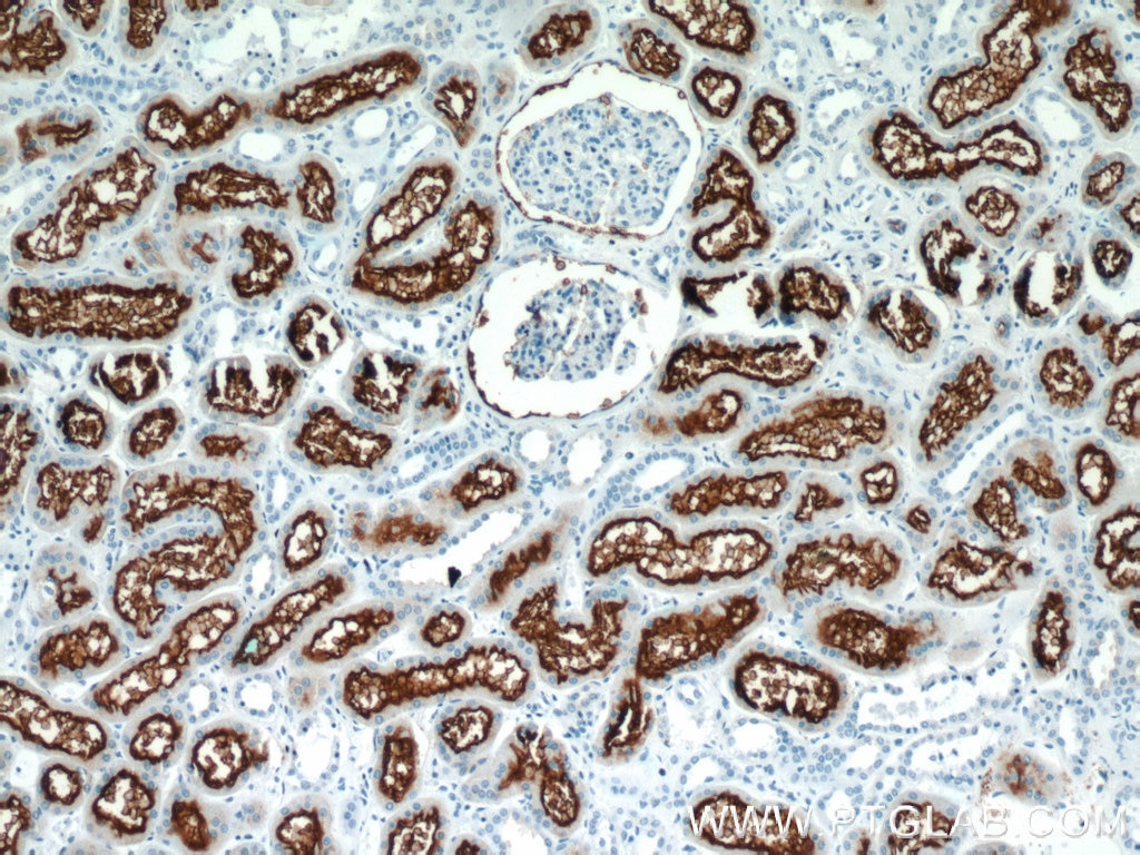 Immunohistochemistry (IHC) staining of human kidney tissue using CD13 Polyclonal antibody (14553-1-AP)
