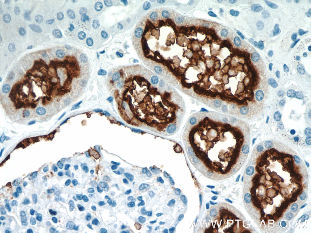 Immunohistochemistry (IHC) staining of human kidney tissue using CD13 Polyclonal antibody (14553-1-AP)