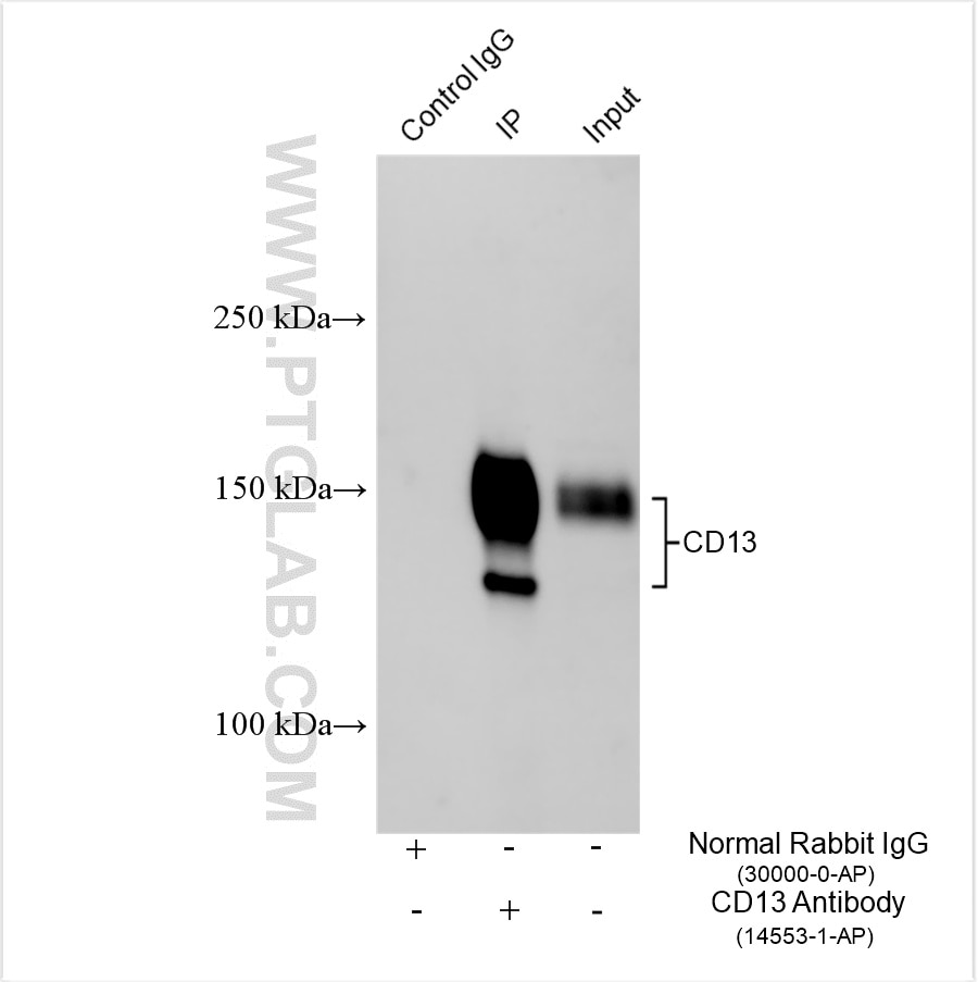 Immunoprecipitation (IP) experiment of HepG2 cells using CD13 Polyclonal antibody (14553-1-AP)