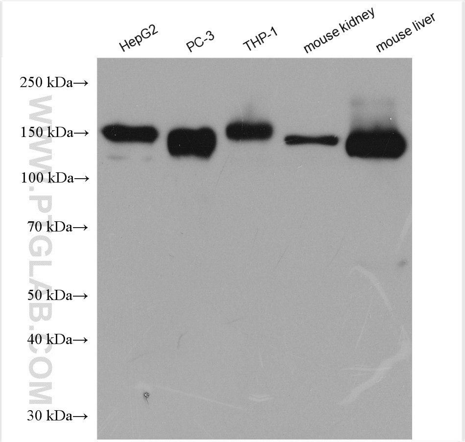 Western Blot (WB) analysis of various lysates using CD13 Polyclonal antibody (14553-1-AP)