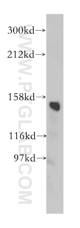 Western Blot (WB) analysis of human liver tissue using CD13 Polyclonal antibody (14553-1-AP)