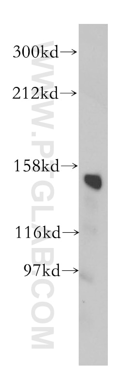 WB analysis of human liver using 14553-1-AP