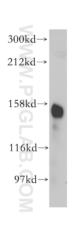 WB analysis of human kidney using 14553-1-AP