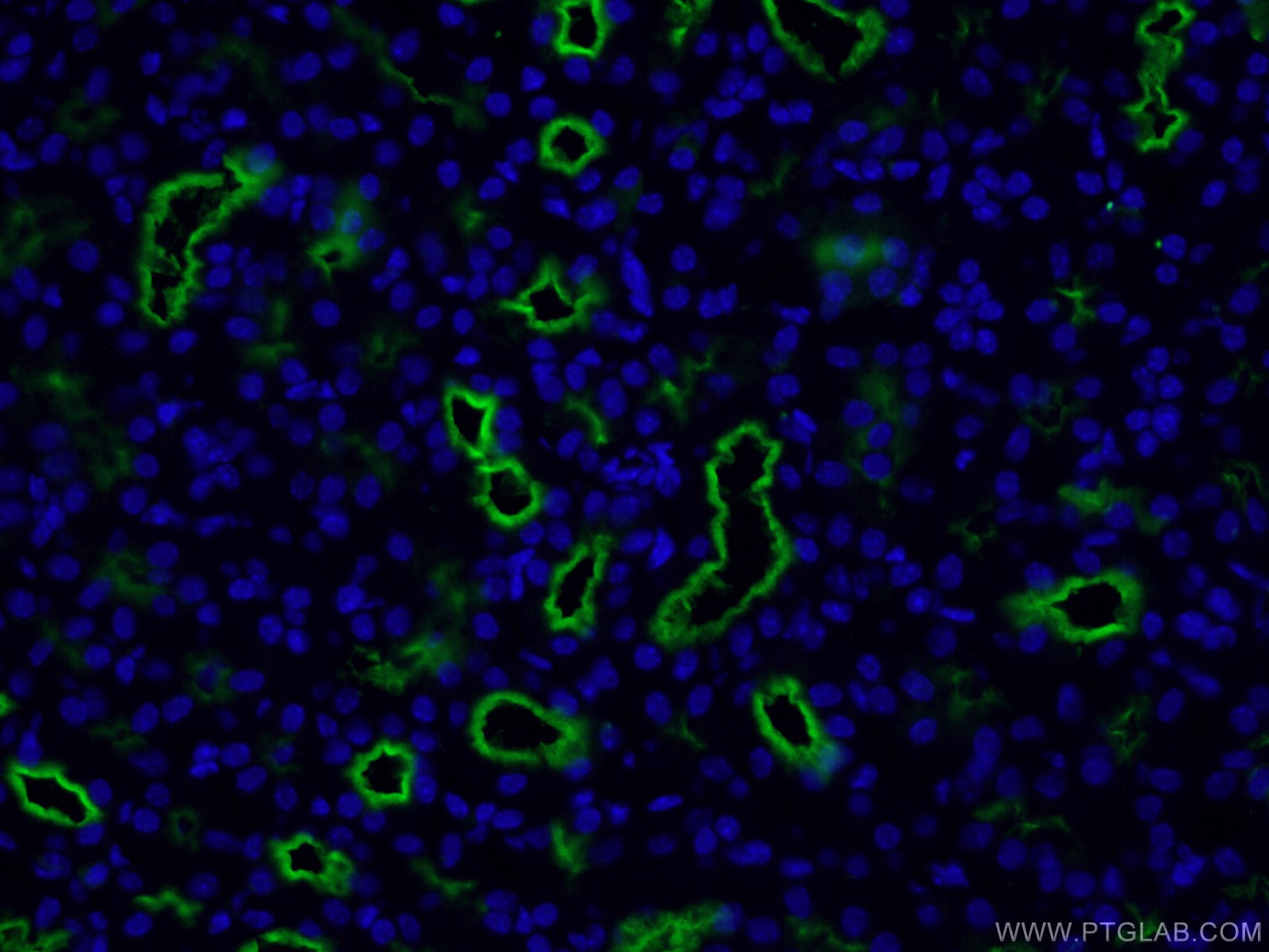 IF Staining of human kidney using 66211-1-Ig