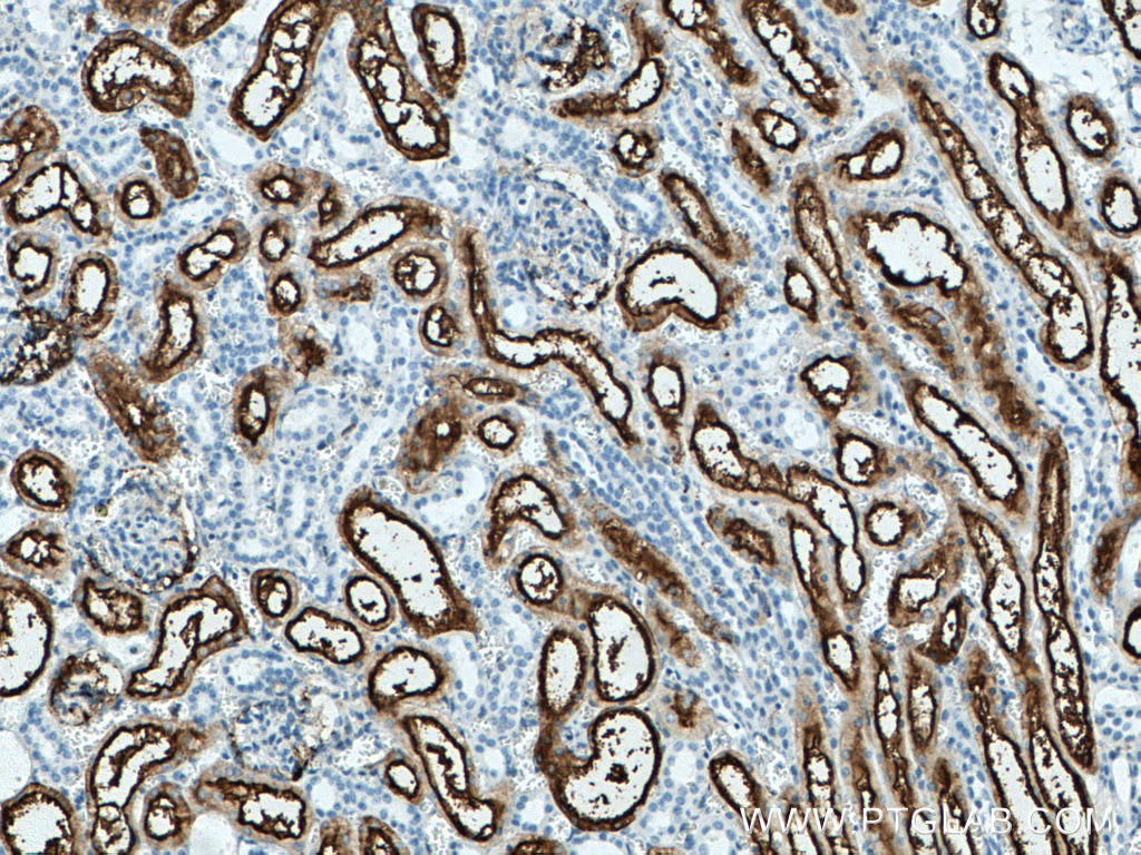 Immunohistochemistry (IHC) staining of human kidney tissue using CD13 Monoclonal antibody (66211-1-Ig)