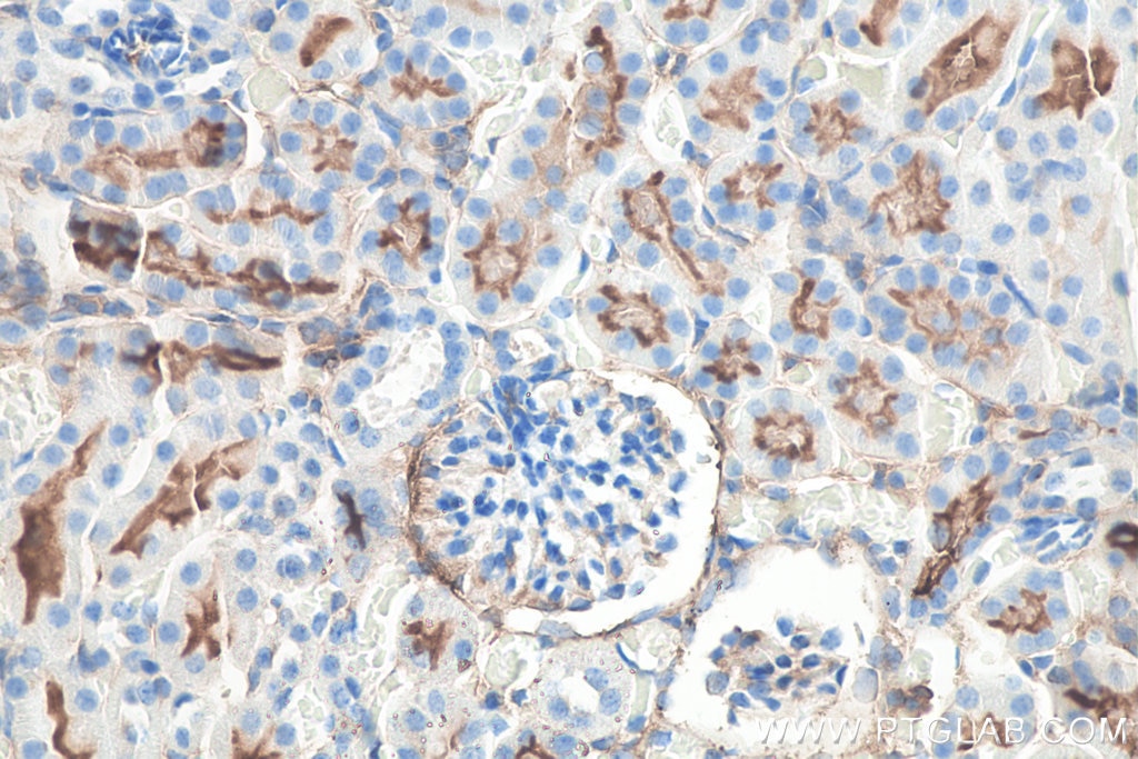 Immunohistochemistry (IHC) staining of mouse kidney tissue using CD13 Monoclonal antibody (66211-1-Ig)
