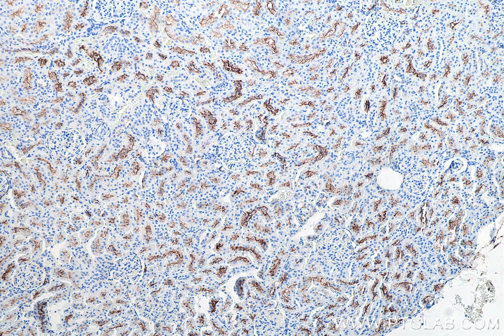 Immunohistochemistry (IHC) staining of rat kidney tissue using CD13 Monoclonal antibody (66211-1-Ig)