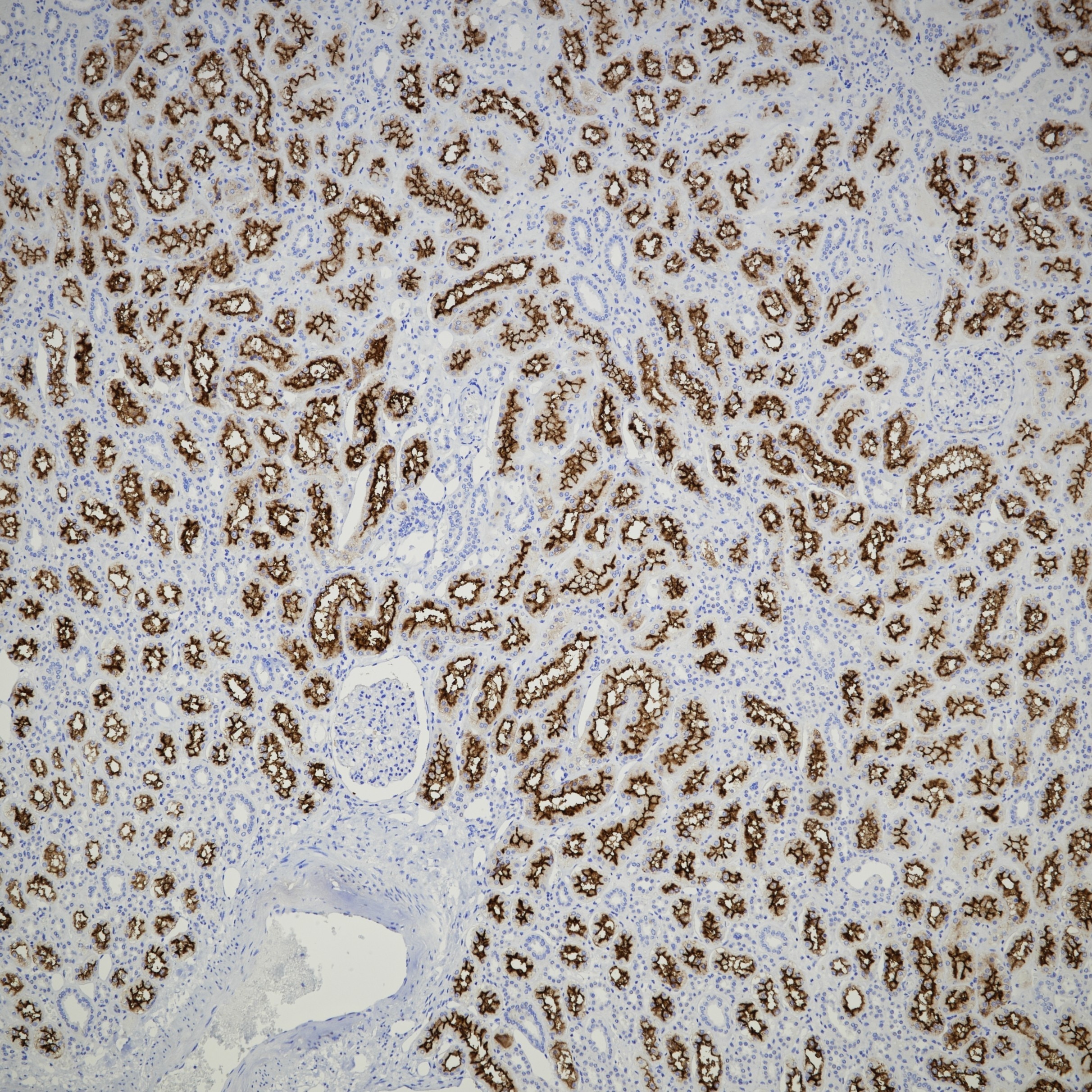 Immunohistochemistry (IHC) staining of human kidney tissue using CD13 Monoclonal antibody (66211-1-Ig)