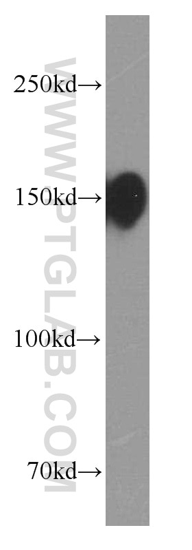 Western Blot (WB) analysis of U-937 cells using CD13 Monoclonal antibody (66211-1-Ig)
