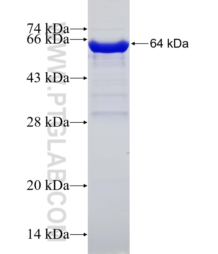 ANPEP fusion protein Ag5976 SDS-PAGE