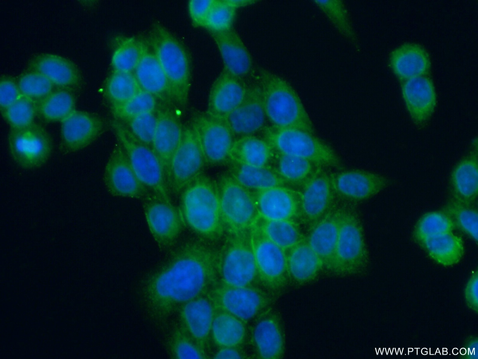Immunofluorescence (IF) / fluorescent staining of HeLa cells using ANTXR1 Polyclonal antibody (15091-1-AP)