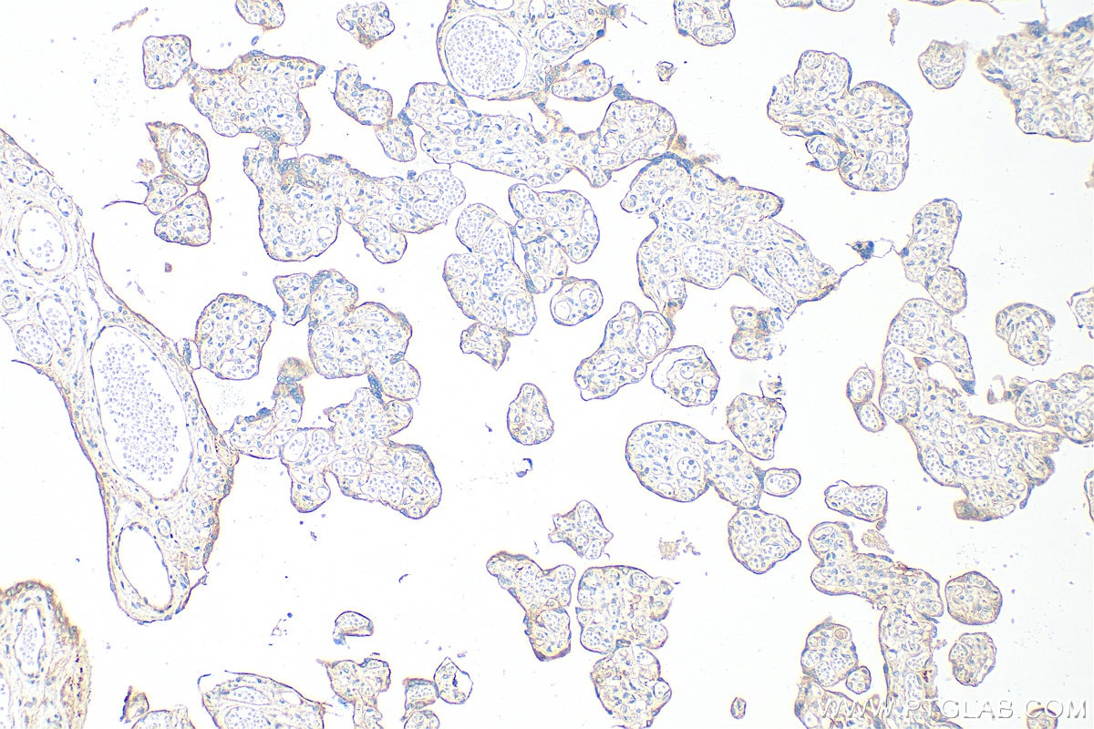 IHC staining of human placenta using 15091-1-AP Immunohistochemistry (IHC) staining of human placenta tissue using ANTXR1 Polyclonal antibody (15091-1-AP)
