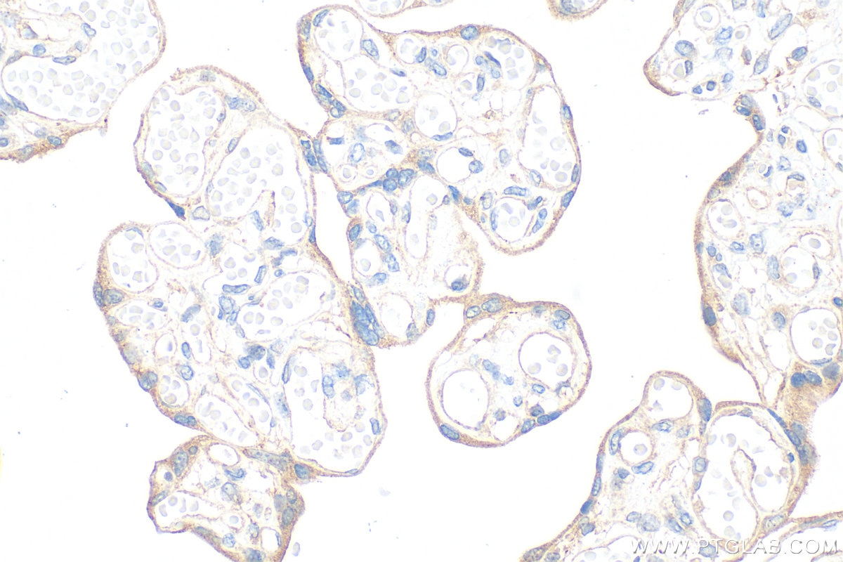 IHC staining of human placenta using 15091-1-AP Immunohistochemistry (IHC) staining of human placenta tissue using ANTXR1 Polyclonal antibody (15091-1-AP)