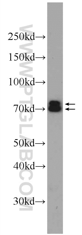Western Blot (WB) analysis of HeLa cells using ANTXR1 Polyclonal antibody (15091-1-AP)