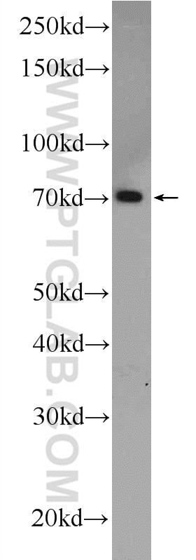 Western Blot (WB) analysis of PC-13 cells using ANTXR1 Polyclonal antibody (15091-1-AP)