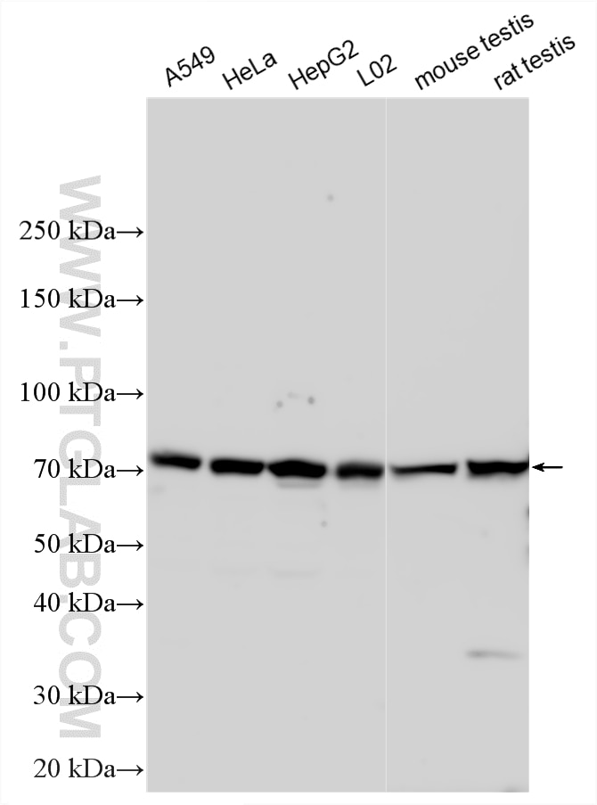 Western Blot (WB) analysis of various lysates using ANTXR1 Polyclonal antibody (15091-1-AP)