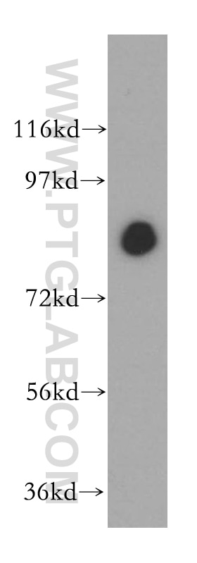 Western Blot (WB) analysis of mouse lung tissue using ANTXR1 Polyclonal antibody (15091-1-AP)