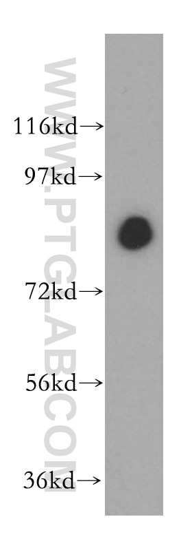 WB analysis of mouse lung using 15091-1-AP