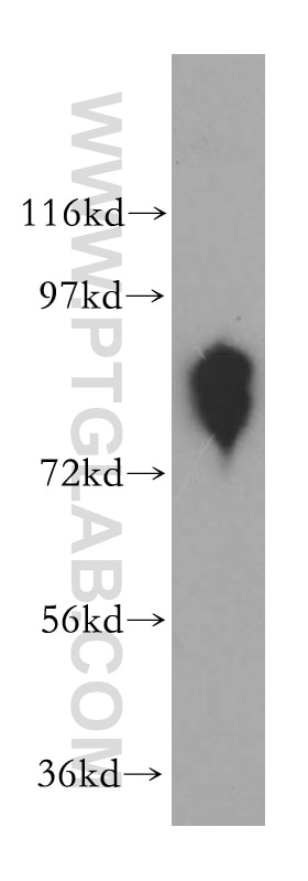 Western Blot (WB) analysis of mouse testis tissue using ANTXR1 Polyclonal antibody (15091-1-AP)