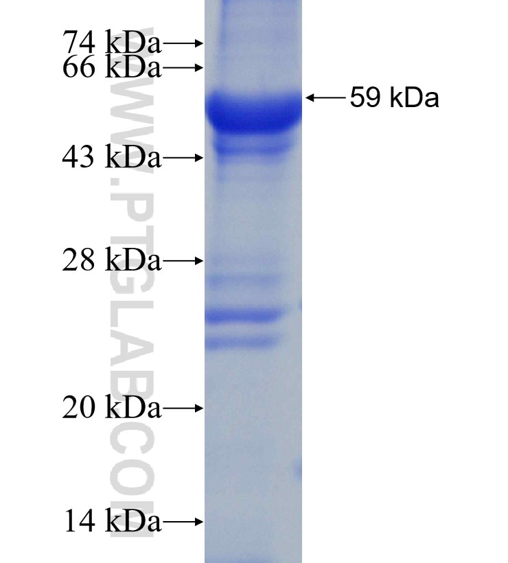 ANTXR1 fusion protein Ag4626 SDS-PAGE