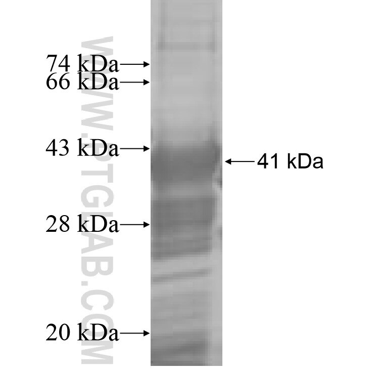 ANTXR1 fusion protein Ag8519 SDS-PAGE
