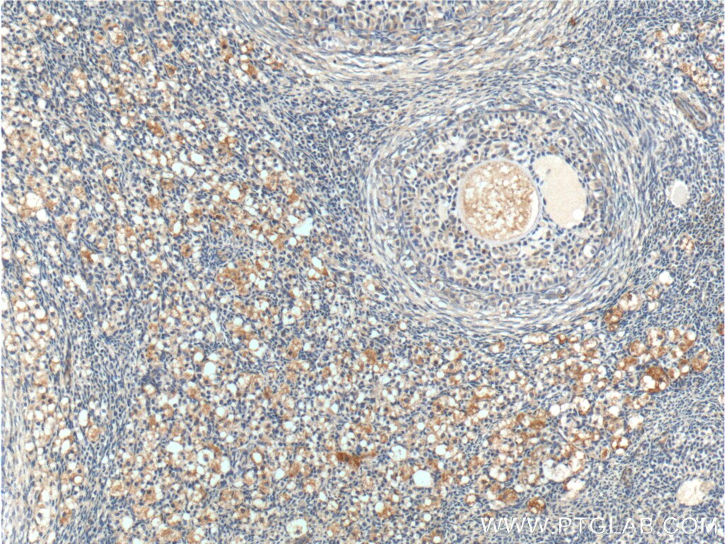 Immunohistochemistry (IHC) staining of human ovary tissue using ANTXR2 Polyclonal antibody (16723-1-AP)