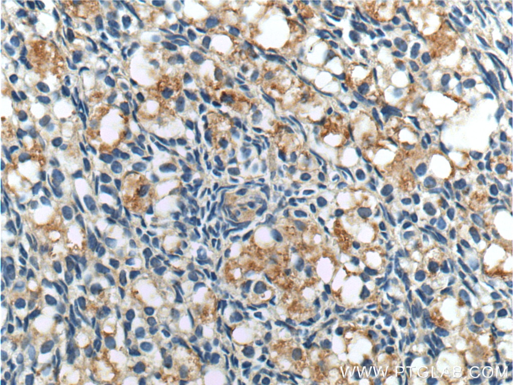 Immunohistochemistry (IHC) staining of human ovary tissue using ANTXR2 Polyclonal antibody (16723-1-AP)