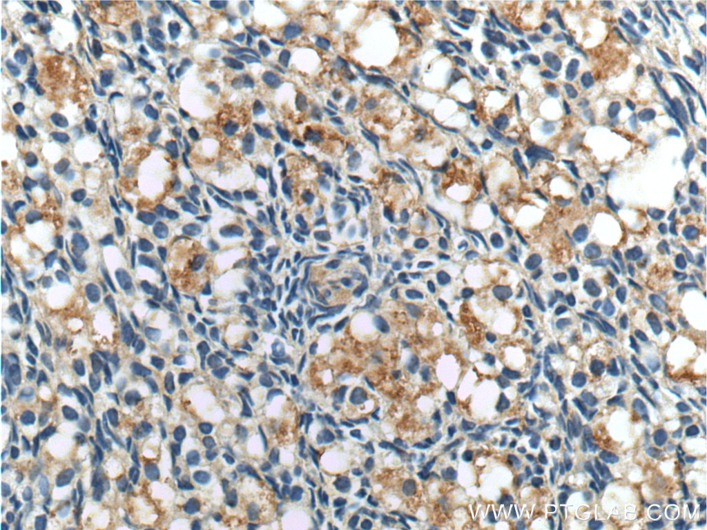 IHC staining of human ovary using 16723-1-AP