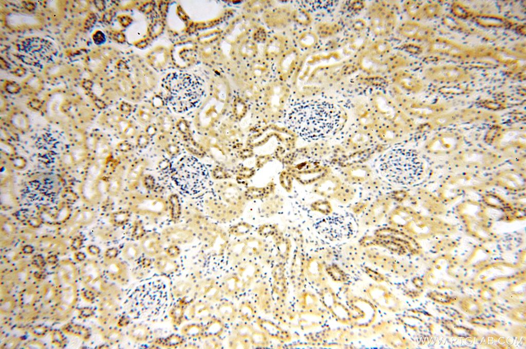 Immunohistochemistry (IHC) staining of human kidney tissue using ANTXR2 Polyclonal antibody (16723-1-AP)