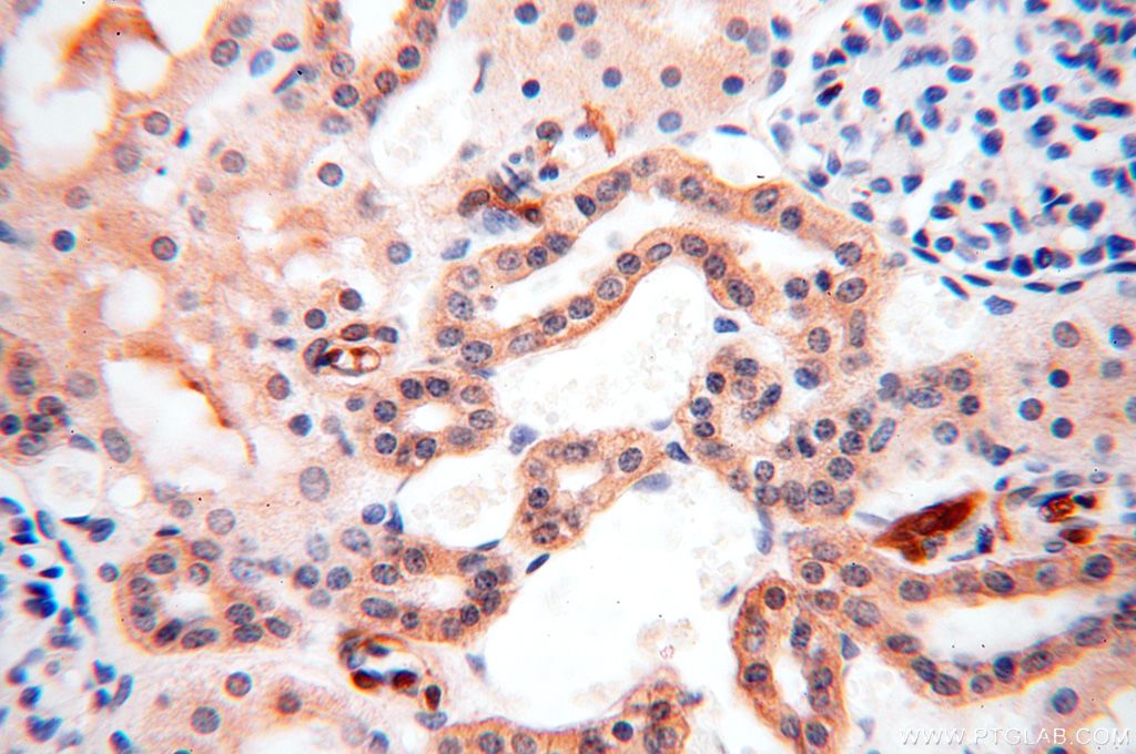 Immunohistochemistry (IHC) staining of human kidney tissue using ANTXR2 Polyclonal antibody (16723-1-AP)