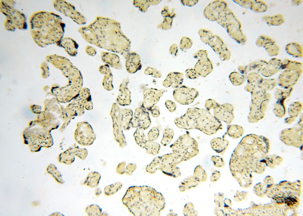 Immunohistochemistry (IHC) staining of human placenta tissue using ANTXR2 Polyclonal antibody (16723-1-AP)