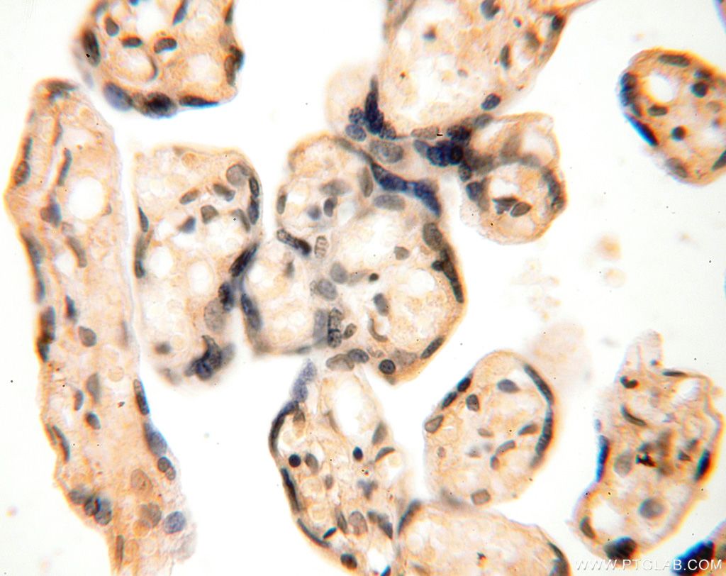 Immunohistochemistry (IHC) staining of human placenta tissue using ANTXR2 Polyclonal antibody (16723-1-AP)