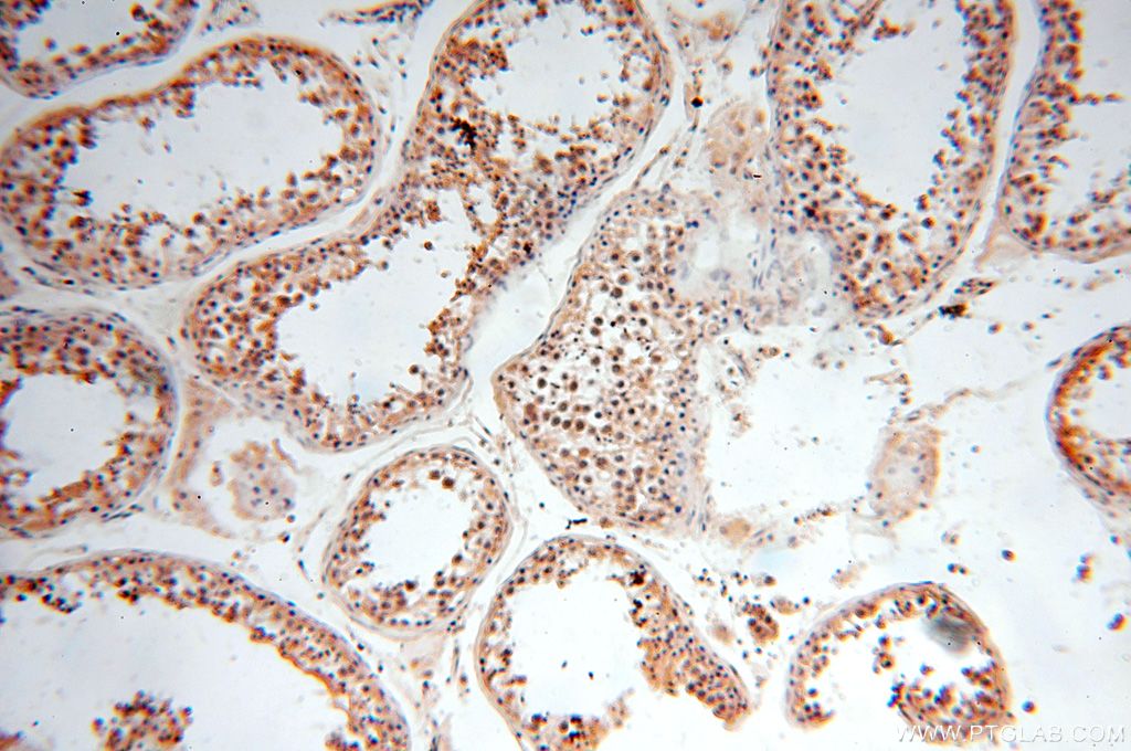 IHC staining of human testis using 16723-1-AP