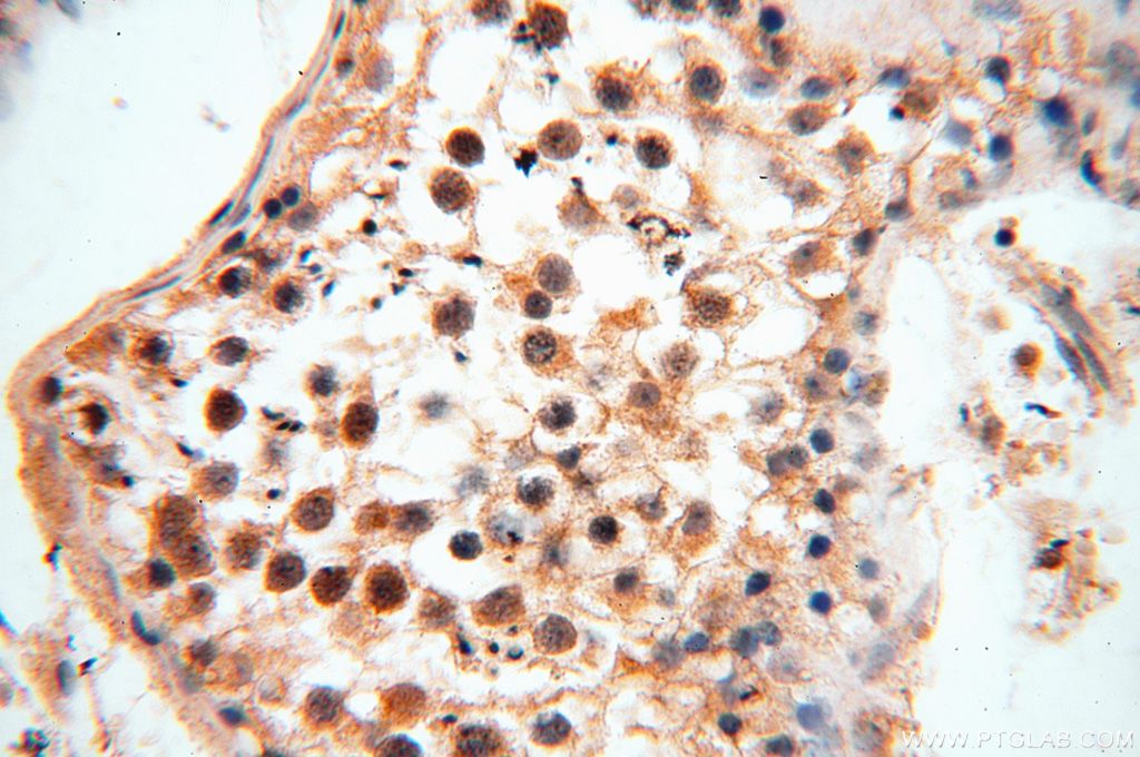 Immunohistochemistry (IHC) staining of human testis tissue using ANTXR2 Polyclonal antibody (16723-1-AP)