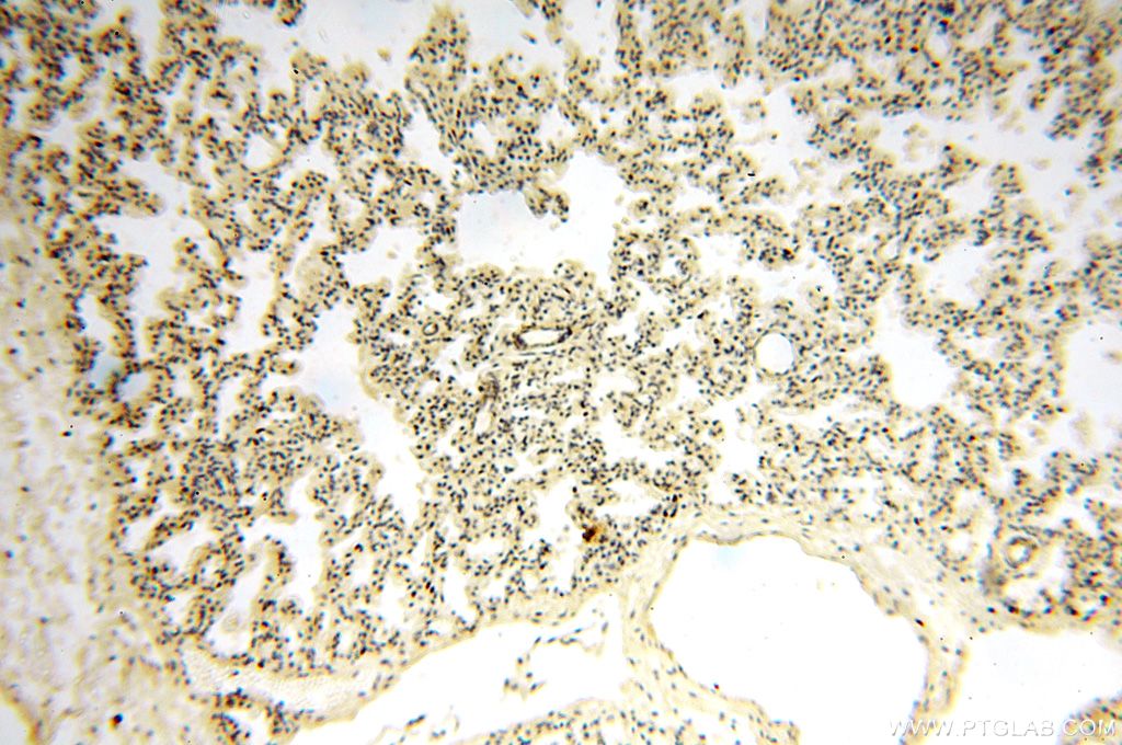 Immunohistochemistry (IHC) staining of human lung tissue using ANTXR2 Polyclonal antibody (16723-1-AP)