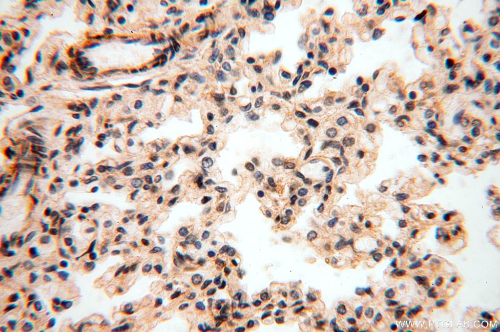 Immunohistochemistry (IHC) staining of human lung tissue using ANTXR2 Polyclonal antibody (16723-1-AP)