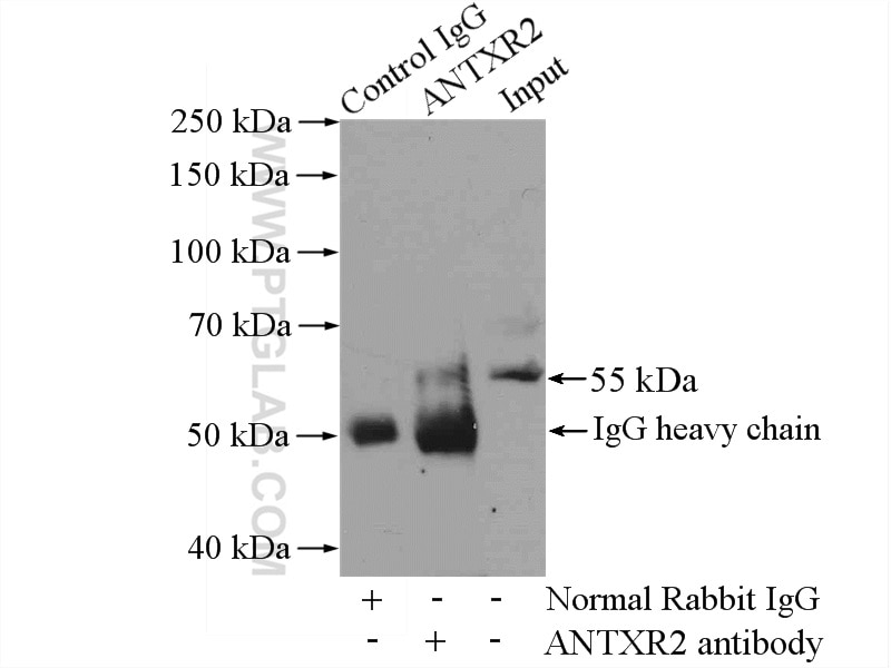 Immunoprecipitation (IP) experiment of HEK-293 cells using ANTXR2 Polyclonal antibody (16723-1-AP)