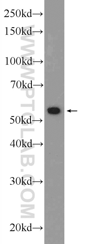 Western Blot (WB) analysis of HEK-293 cells using ANTXR2 Polyclonal antibody (16723-1-AP)