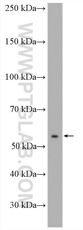 Western Blot (WB) analysis of PC-3 cells using ANTXR2 Polyclonal antibody (16723-1-AP)