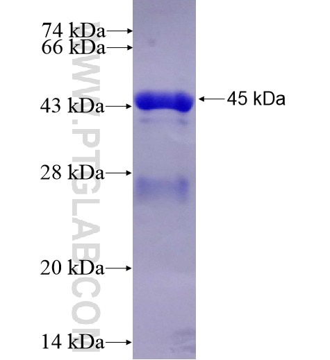 ANTXR2 fusion protein Ag10162 SDS-PAGE