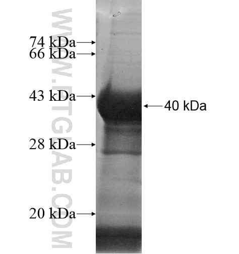 ANUBL1 fusion protein Ag11546 SDS-PAGE