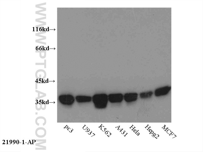 WB analysis of multi-cells using 21990-1-AP